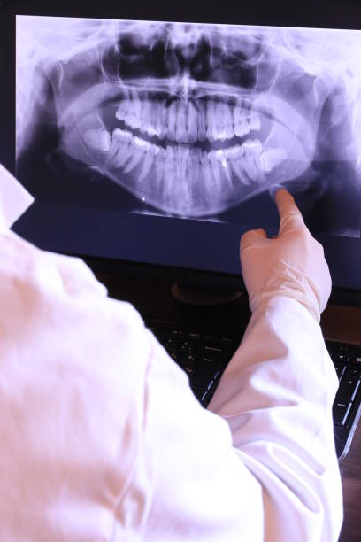 Best Dental Abscess Treatment in Commercial Point, OH