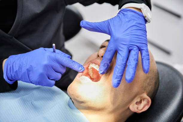 Best Emergency Dental Care for Sports Injuries in Commercial Point, OH